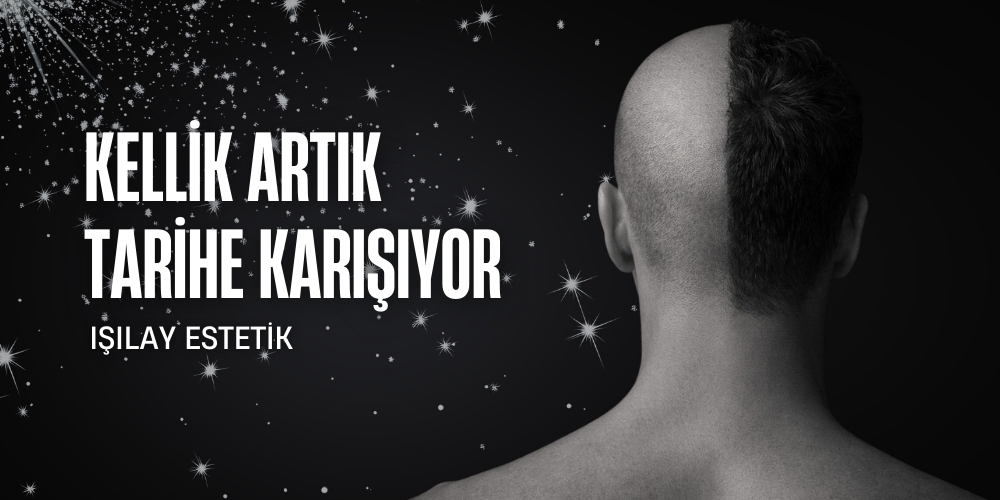 Bir başlık ekleyin (3)